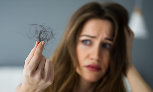 What-Causes-Hair-Loss