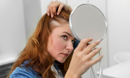 Causes of Hair Loss among Women