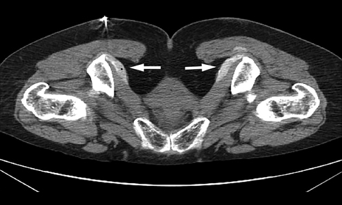 Diagnosis and Assessment